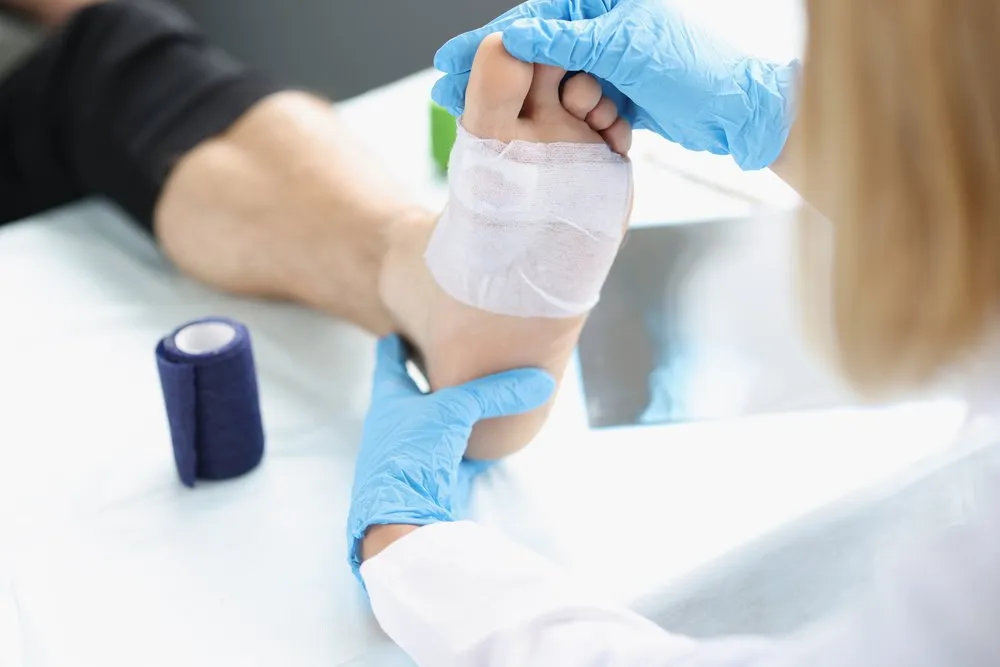 Langkah-Langkah Pertolongan Pertama pada Luka Diabetes