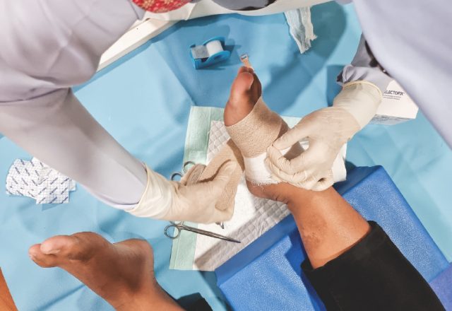 Teknologi Terkini dalam Perawatan Luka Diabetes: Debridement, VAC, dan Lainnya